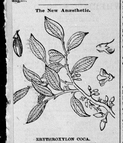 "The New Anaesthetic," [Terre Haute] Saturday Evening Mail, February 21, 1885, 8, Hoosier State Chronicles.